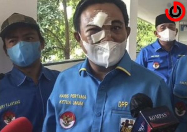 Ketua Umum DPP Komite Nasional Pemuda Indonesia (KNPI) Haris Pertama hadir dengan wajah babak belur sebagai saksi sidang kasus ujaran kebencian terdakwa Ferdinand Hutahaean ©Dok/Istimewa 